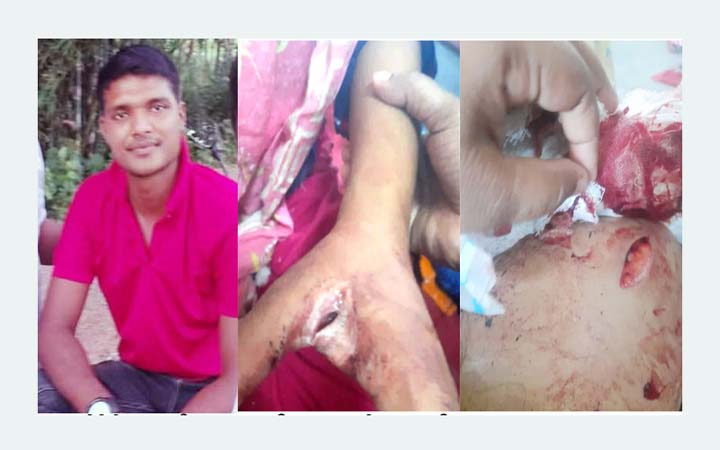 যৌতুকের দাবিতে স্ত্রী ও শ্বশুর-শাশুড়িকে কুপিয়ে আহত  করলো বিজিবি সদস্য