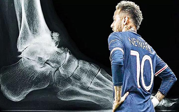 আট সপ্তাহের জন্য মাঠের বাইরে নেইমার