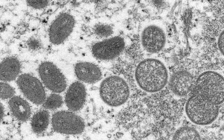 মাঙ্কিপক্সে ২১ দিনের কোয়ারেন্টাইন