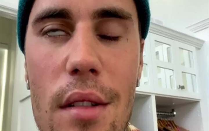 র‍্যামজে হান্ট সিনড্রোম কী ধরনের অসুখ যাতে জাস্টিন বিবারের মুখ অবশ হয়েছে