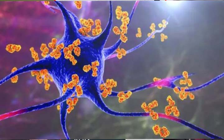 অটোইমিউন ডিজিজ : যে অসুখে রোগ প্রতিরোধ ক্ষমতা উল্টো কাজ করে