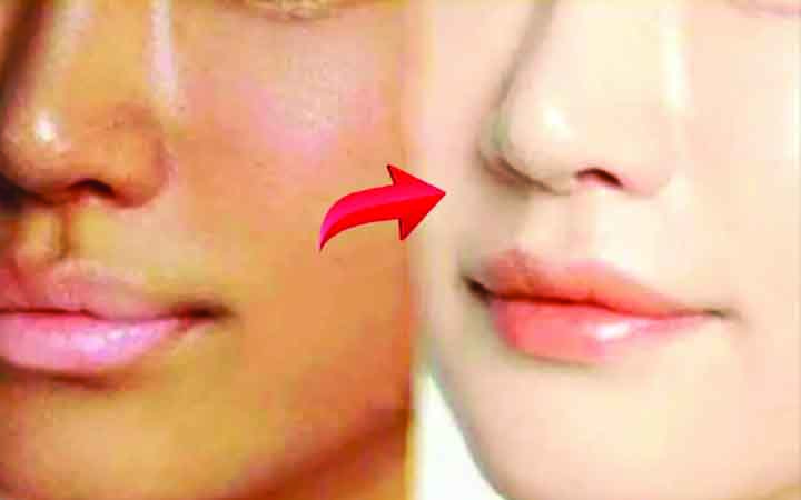 নিমেষে দূর হবে মুখের কালো দাগ
