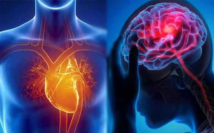 শীতকালে স্ট্রোকের ঝুঁকি বাড়ার কারণ