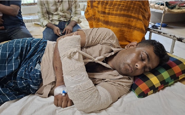 লক্ষ্মীপুরে ইন্টারনেটের বিল চাওয়ায় ব্যবসায়ীর হাত ভেঙে দিলেন যুবদল নেতা