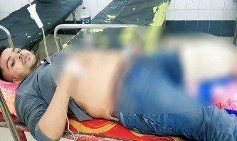 আশুলিয়ায় এক যুবক গুলিবিদ্ধ