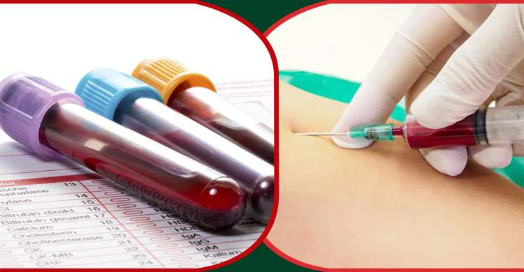 নিয়মিত রক্ত পরীক্ষা করা জরুরি কেন?