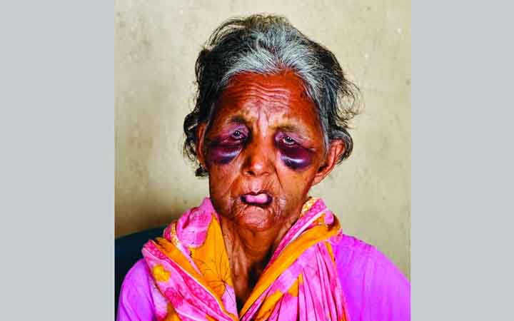 দুর্বৃত্তের হামলায় নিভে গেল সেই বাকপ্রতিবন্ধী পরিচ্ছন্নতা কর্মী ববির জীবন