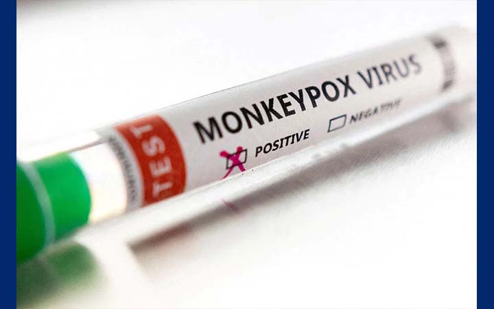 প্রবাসে মাঙ্কিপক্সে বাংলাদেশির মৃত্যু, স্বাস্থ্যবিধি মেনে কুমিল্লায় দাফন