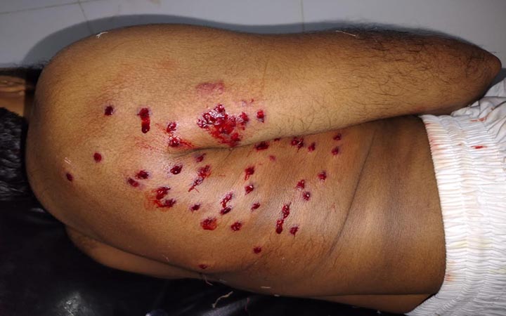 নোয়াখালীতে মোটরসাইকেল ছিনতাই করতে মাদরাসা শিক্ষককে গুলি