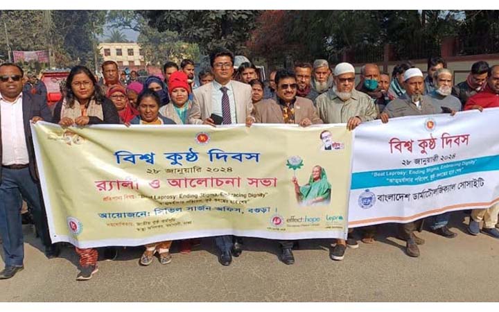 বগুড়ায় বিশ্ব কুষ্ঠ দিবস পালিত