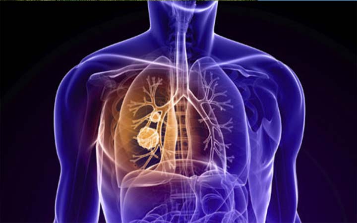 ফুসফুসকে সুস্থ রাখতে যা খাবেন