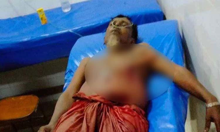 ব্রাহ্মণবাড়িয়ায় দুই পক্ষের সংঘর্ষে আহত ২০