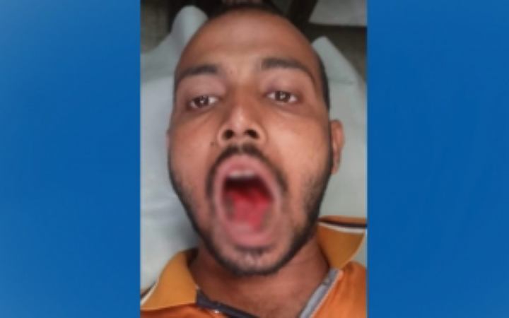 যশোরে স্বামীর জিহ্বা কামড়ে ছিড়ে নিলো স্ত্রী