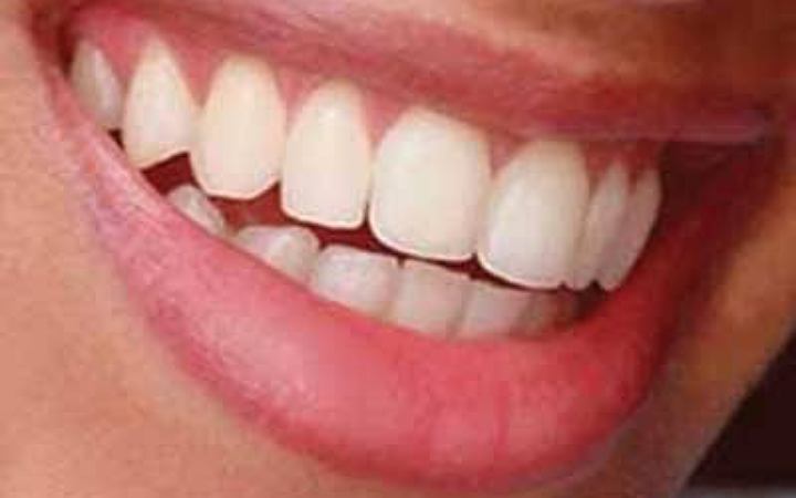 ঘরোয়া টোটকায় দাঁত জীবাণুমুক্ত করার উপায়