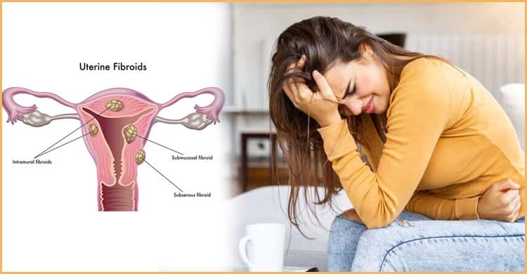 জরায়ুতে টিউমার আছে কি না বুঝবেন যে লক্ষণে
