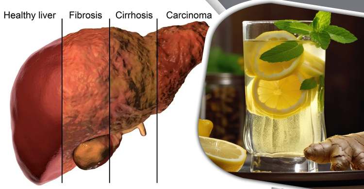 লিভার সুস্থ রাখতে যা পান করবেন