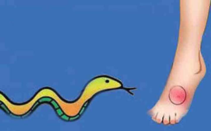 সাপের কামড়ে প্রতিবছর সাড়ে ৭ হাজার মানুষের মৃত্যু