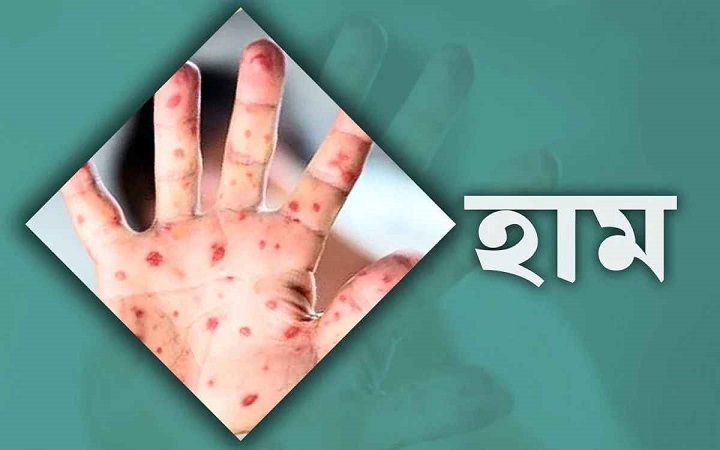 সিলেটে আরও দুই মৃত্যু, হাসপাতালে ১৫৮ জন