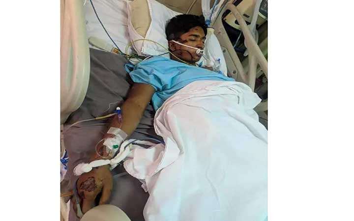 সড়ক দুর্ঘটনায় আহত বশেমুরবিপ্রবি শিক্ষার্থী  সুস্থের পথে ; দুয়া প্রার্থনা "