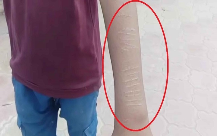 ব্লেডে কাটা দাগ দূর করার উপায় কী?