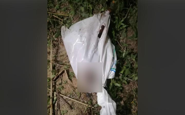 রামুতে পলিথিন ব্যাগে মোড়ানো কাটা পা উদ্ধার