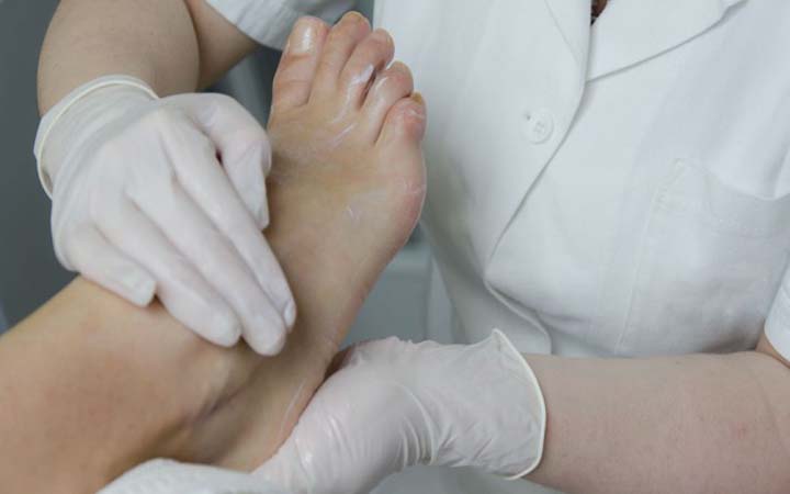 ডায়াবিটিস রোগীদের পায়ের যত্ন