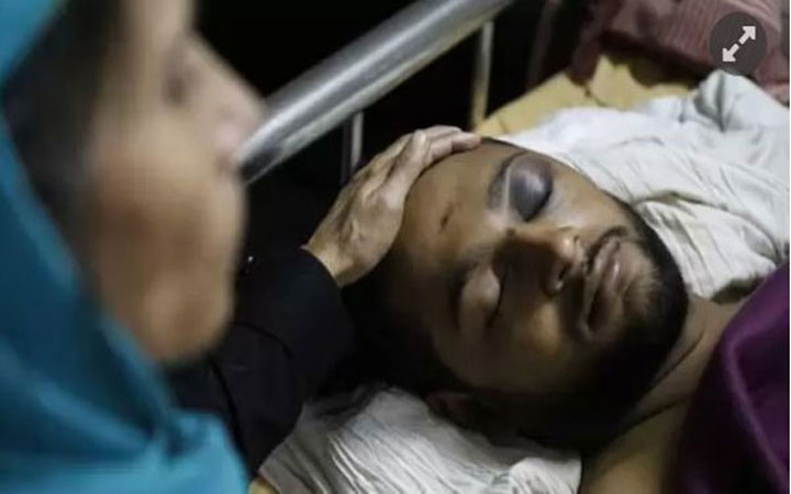 ডাকসুর ছাদ থেকে ফেলে দেয়া সুহেল আইসিইউতে
