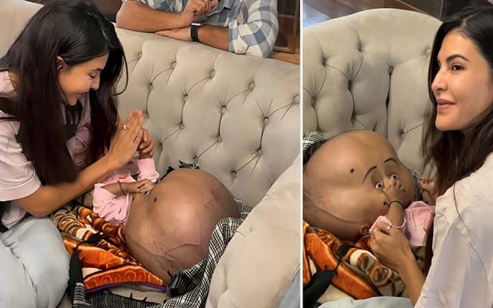 বিরল রোগে আক্রান্ত শিশুর চিকিৎসার দায়িত্ব নিলেন জ্যাকলিন