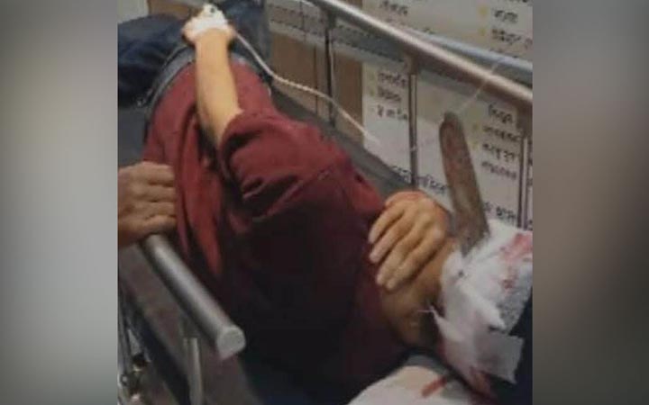 জাবিতে ঘাস কাটা মেশিনের ব্লেড ভেঙে ঢুকল যুবকের মাথায়