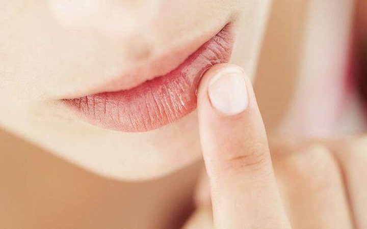 ঘরোয়া উপায়ে ঠোঁট ফাটা থেকে মুক্তি