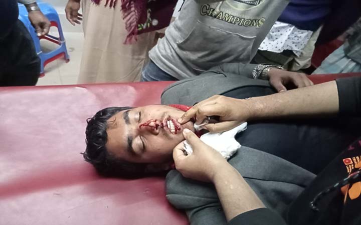 নৌকার সমর্থকদের হামলায় টিভি ক্যামেরাপার্সন আহত