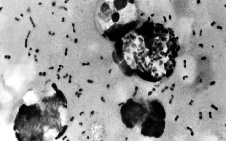 চীনে ভয়ঙ্কর প্লেগের হানা, নতুন সতর্কতা জারি