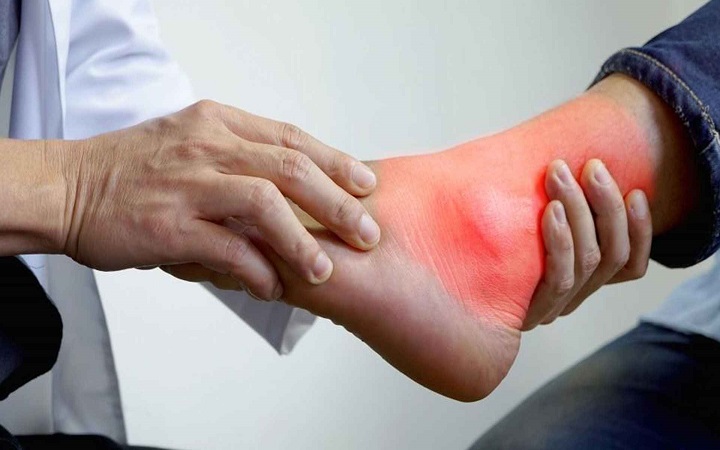 ইউরিক অ্যাসিড বেড়ে যাওয়ার লক্ষণ