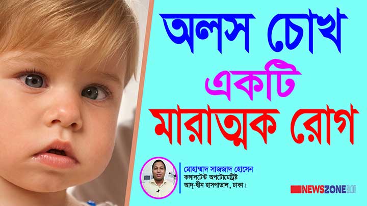 অলস চোখ একটি মারাত্মক রোগ