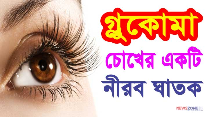 গ্লুকোমা চোখের নিরব ঘাতক