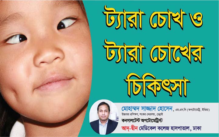 ট্যারা চোখ ও ট্যারা চোখের চিকিৎসা।। Strabismus and treatment