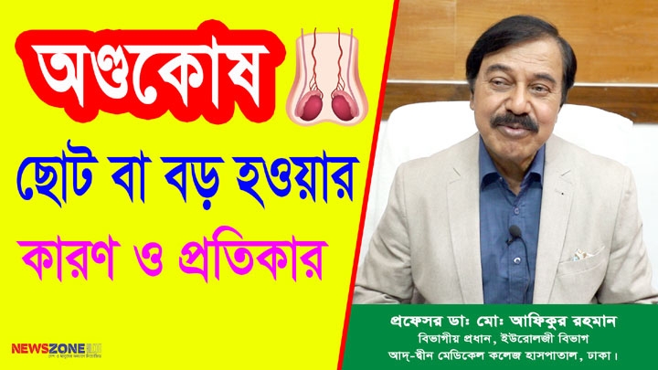 অণ্ডকোষ ছোট বা বড় হওয়ার কারণ ও প্রতিকার